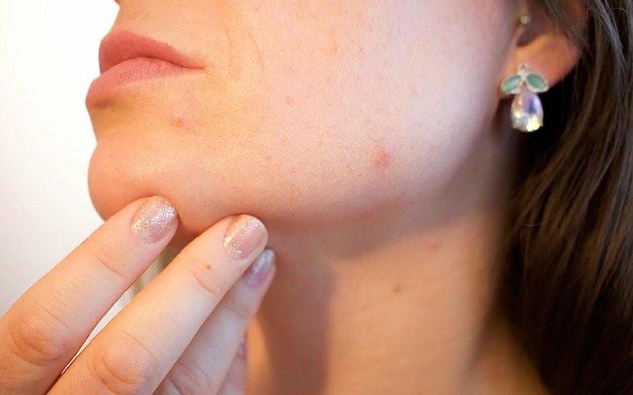 Evo zašto vam koža izgleda tako loše tokom izolacije?