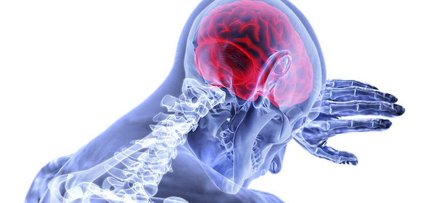 Šta treba da znate o simptomima PRETEĆEG moždanog udara