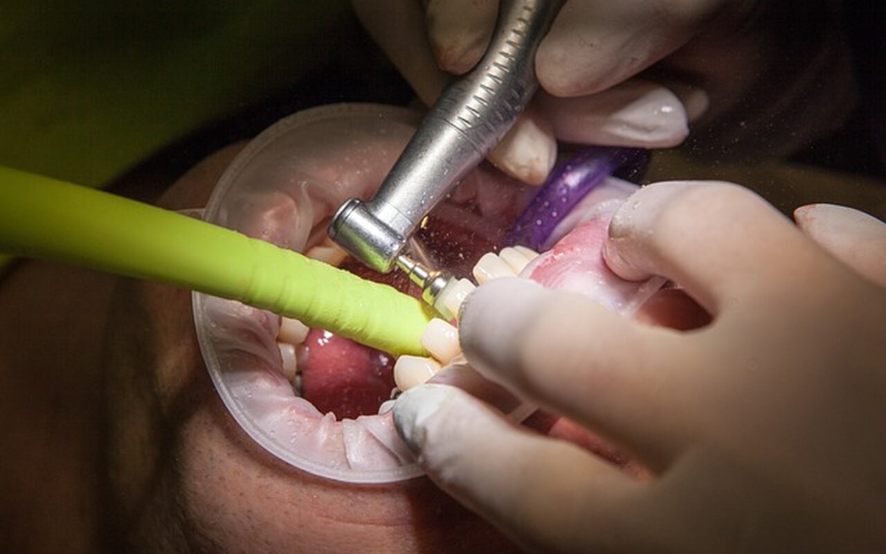 Kako nesvesno oštećujete zubnu gleđ?