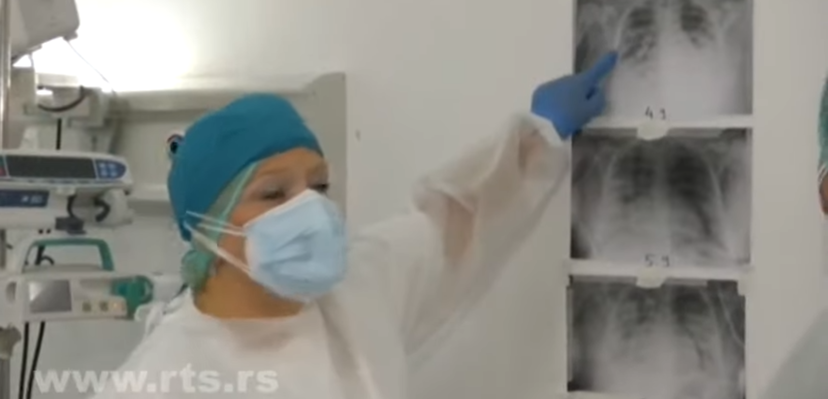 Pogledajte potresni snimak, korona UNIŠTILA pluća zdravoj devojci od samo 20 godina (VIDEO)