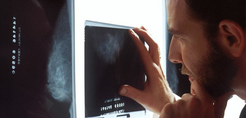 Rak prostate u Srbiji pogađa više od 2.000 muškaraca godišnje
