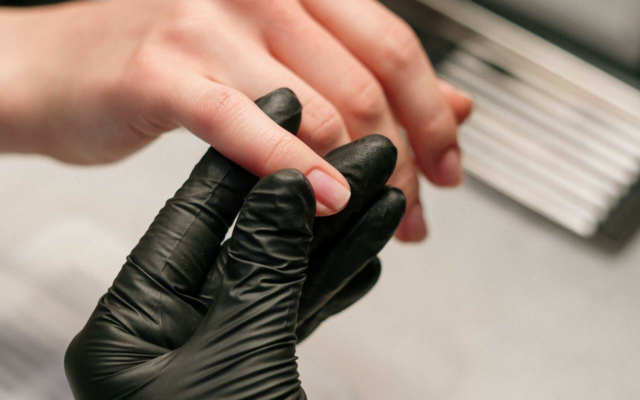 Zdravlje noktiju – ogledalo opšteg stanja organizma