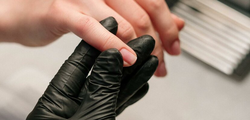 Zdravlje noktiju – ogledalo opšteg stanja organizma