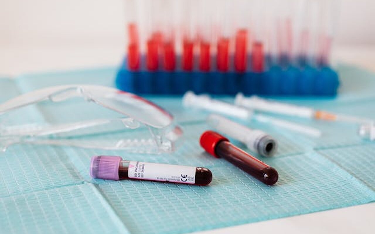 Muškarci stariji od 50: Besplatan PSA test bez zakazivanja u Beogradu
