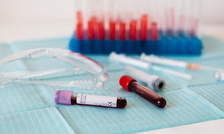 Muškarci stariji od 50: Besplatan PSA test bez zakazivanja u Beogradu