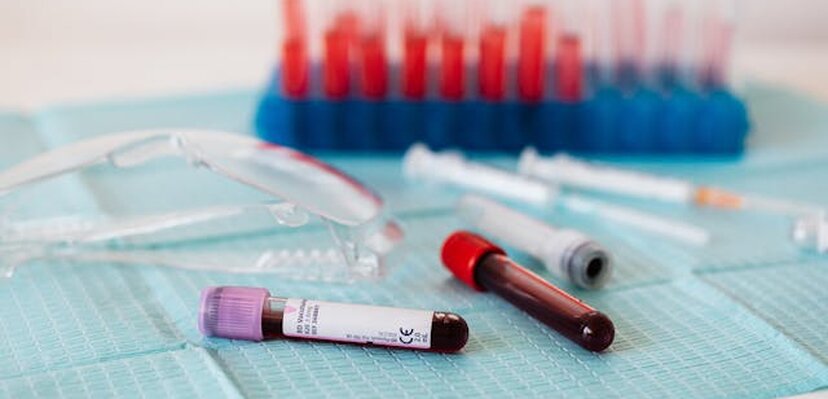 Muškarci stariji od 50: Besplatan PSA test bez zakazivanja u Beogradu
